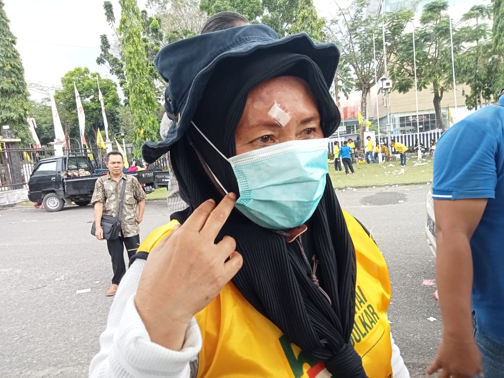 Akibat Kelalaian Panitia HUT Golkar Ke.58 Seorang Ibu Cidera Karena Lemparan Botol